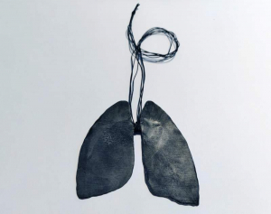 sorry, minified image is missing, click to see the bigger version